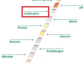 what does leukocyte esterase positive mean
