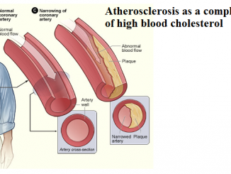 What is considered a dangerous level of cholesterol? What are the risks of high cholesterol?