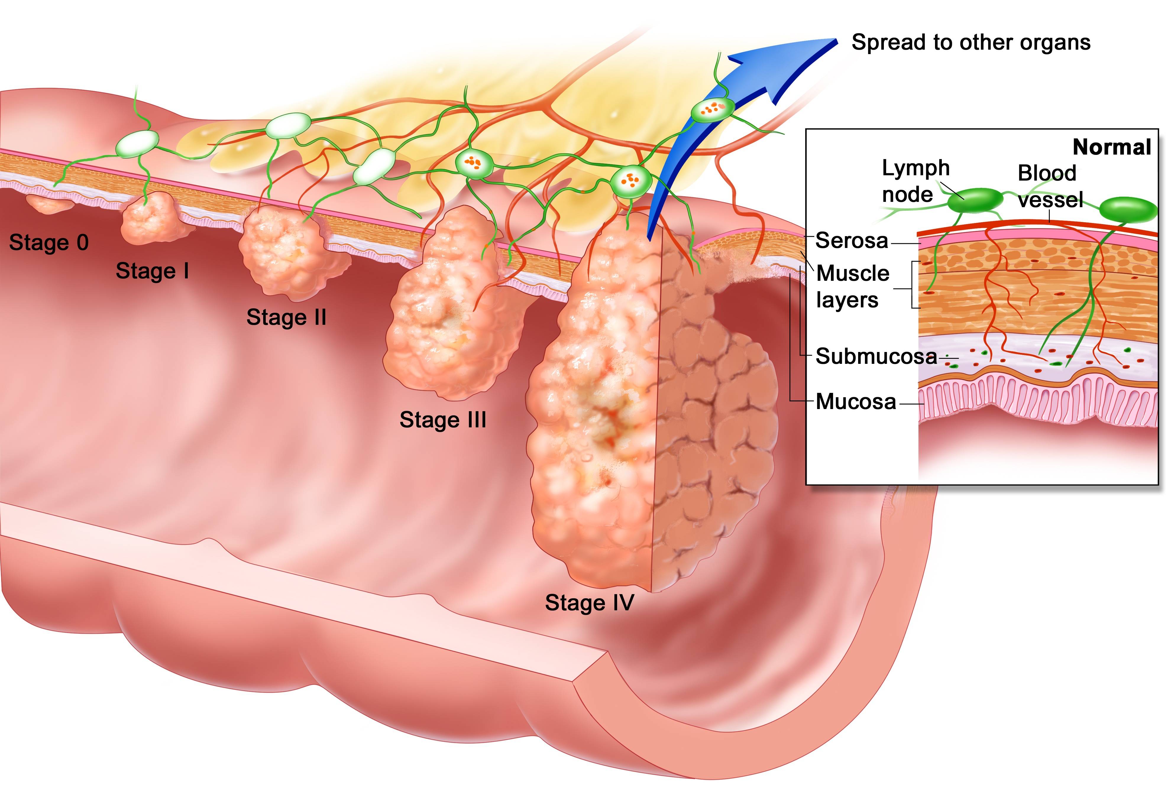 Odynophagia Medical Term Signs And Symptoms Causes Treatments Vs 