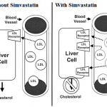 simvastatin mechanism of action