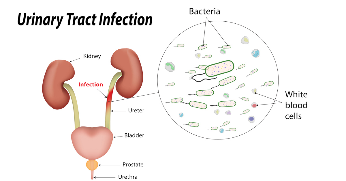 Pyuria Drugs Details
