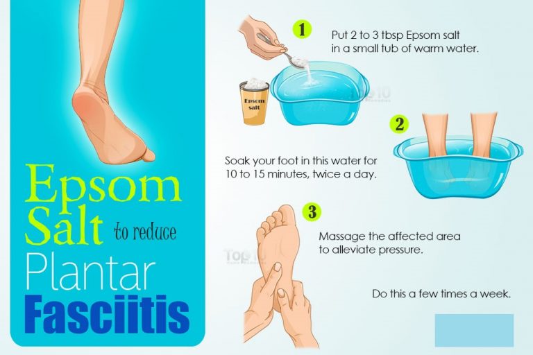 Plantar Fasciitis definition, symptoms, causes
