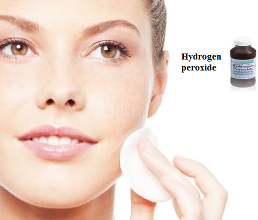 does hydrogen peroxide expire