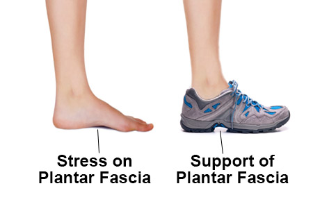 plantar fasciitis sock arch support