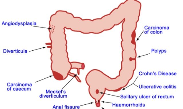 Distended erect clitoris