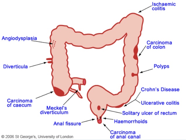 Gastrointestinales significado