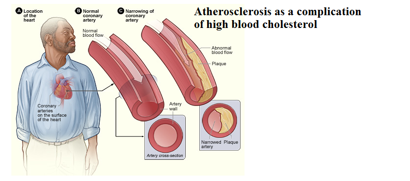 Can you feel tired with high cholesterol?