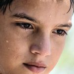 What is Diaphoresis and excessive diaphoresis? - Types, Causes and Treatments