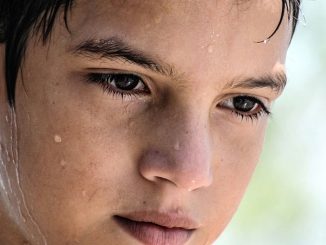 What is Diaphoresis and excessive diaphoresis? - Types, Causes and Treatments