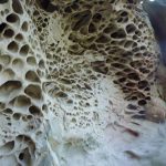 What is Trypophobia? And Is It Real?
